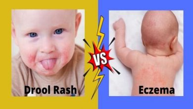 drool rash vs eczema